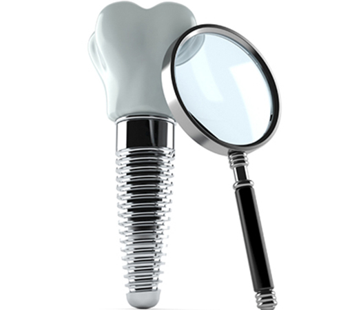 Dental Implants, Mount Pearl Dentist